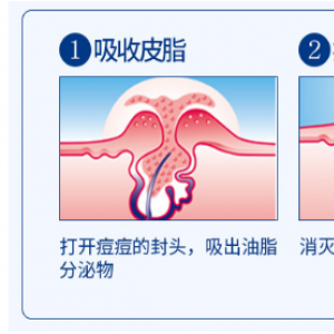 不知道就吃大亏了！最具日本人信赖的祛痘药膏！！